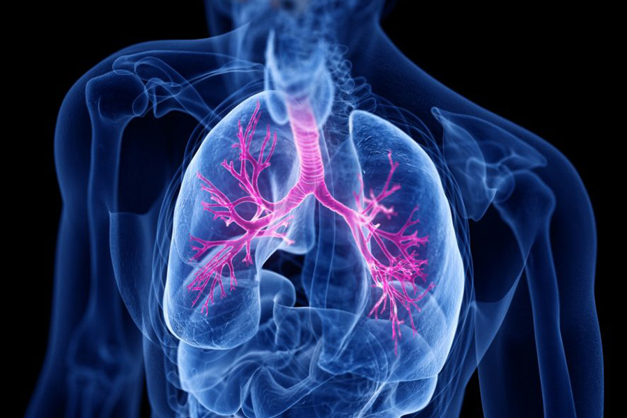 Vivere con l’asma grave: Il “viaggio” del paziente | Parte 2